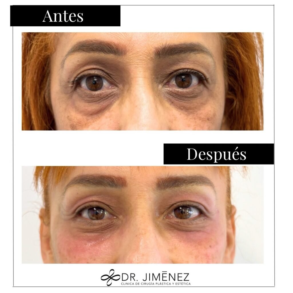 Instagram post from clinicadr.jimenez. This post is in position 0.