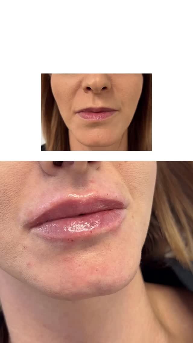 Instagram post from clinicadr.jimenez. This post is in position 1.