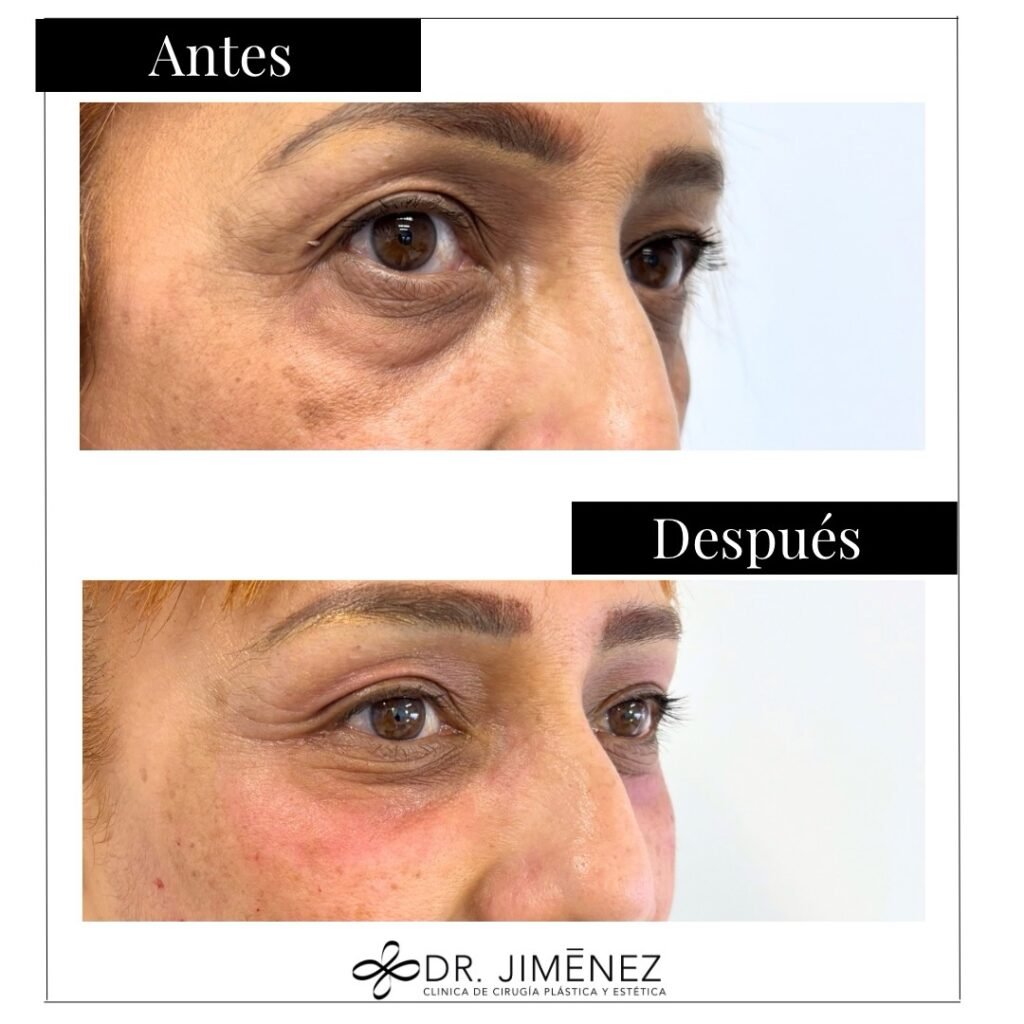 Instagram post from clinicadr.jimenez. This post is in position 1.