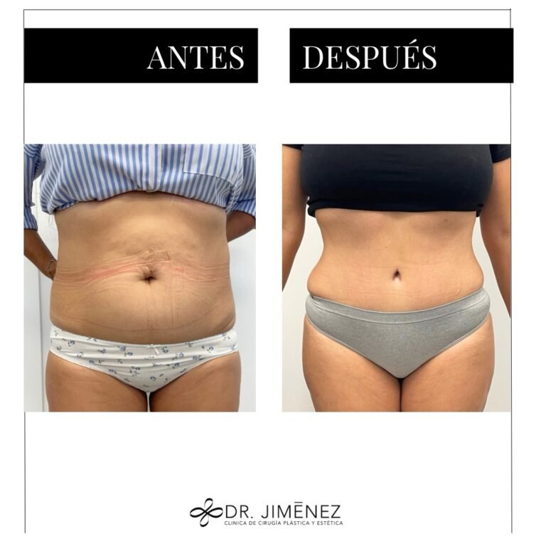 Instagram post from clinicadr.jimenez. This post is in position 3.