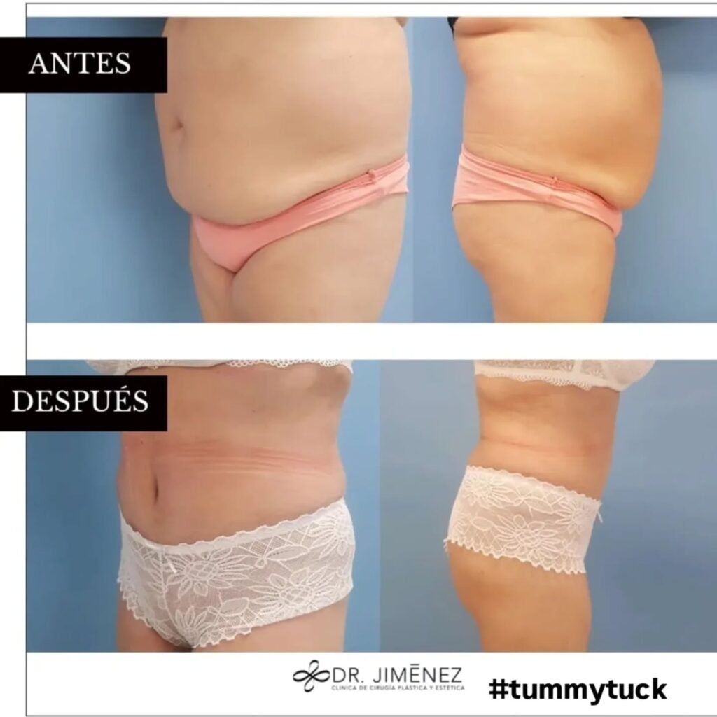 Instagram post from clinicadr.jimenez. This post is in position 1.