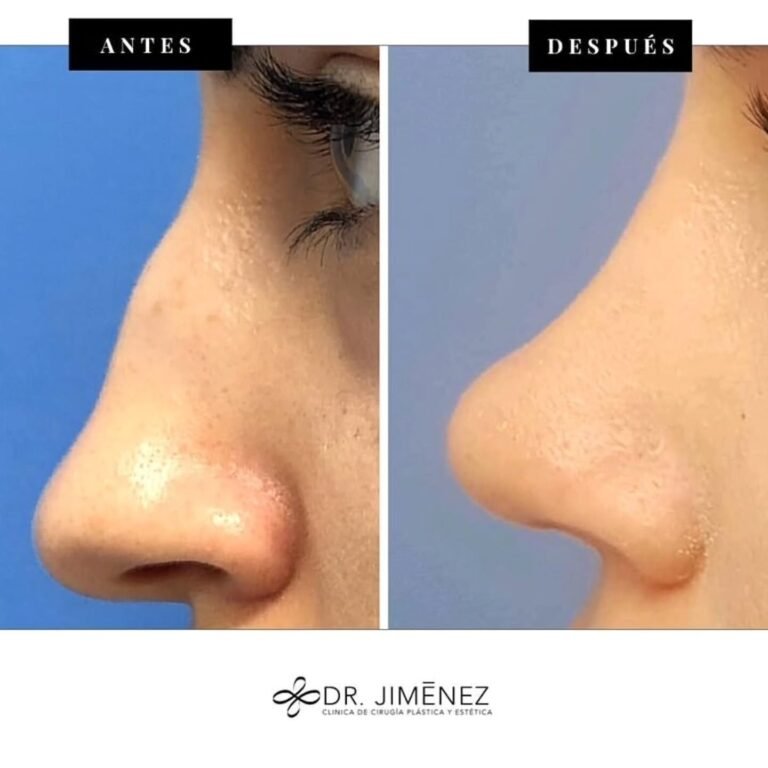 Instagram post from clinicadr.jimenez. This post is in position 1.
