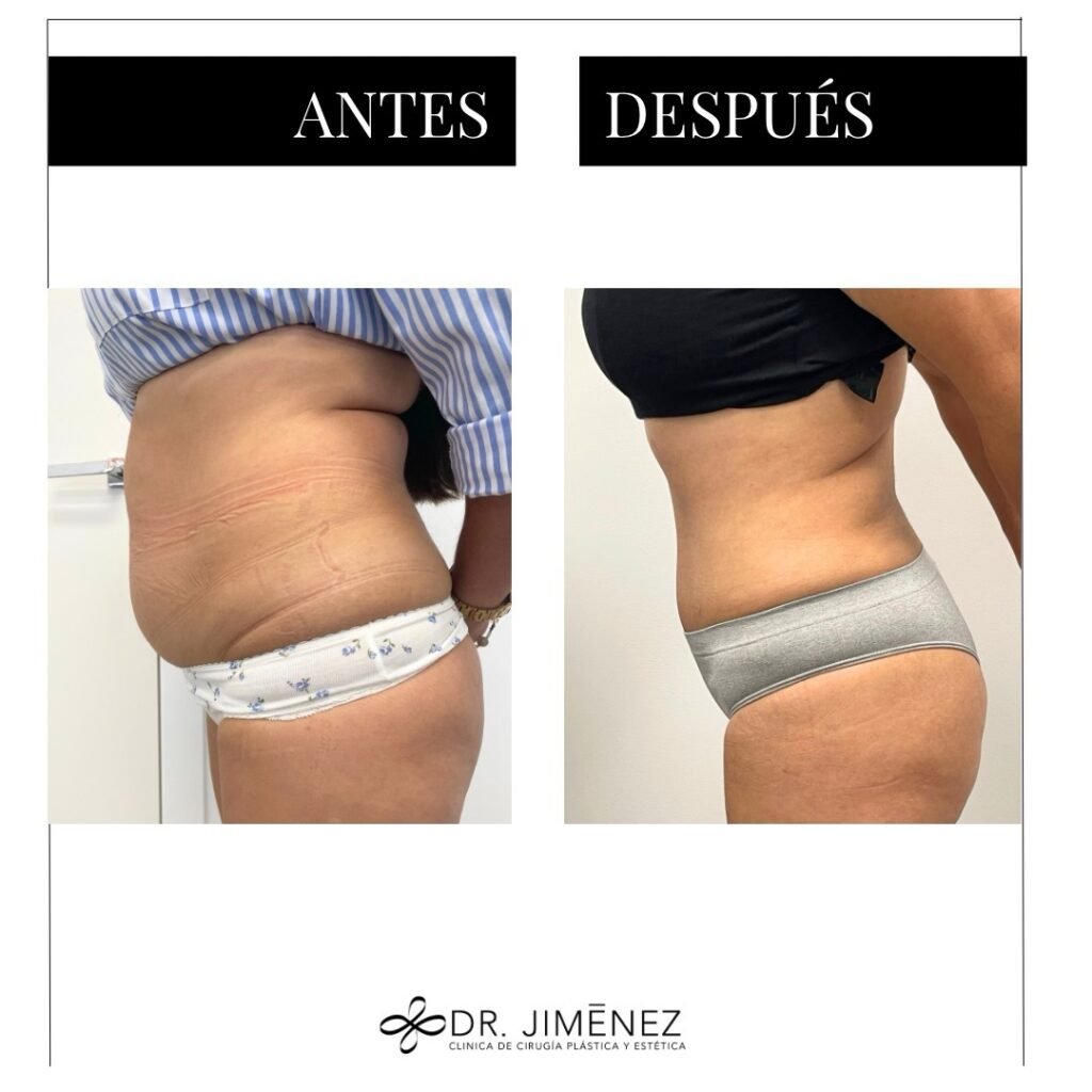 Instagram post from clinicadr.jimenez. This post is in position 2.