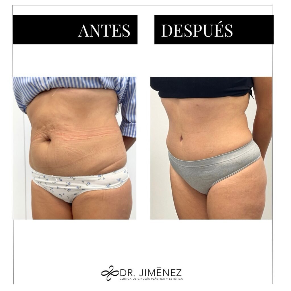 Instagram post from clinicadr.jimenez. This post is in position 1.