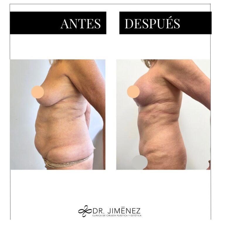 Instagram post from clinicadr.jimenez. This post is in position 4.