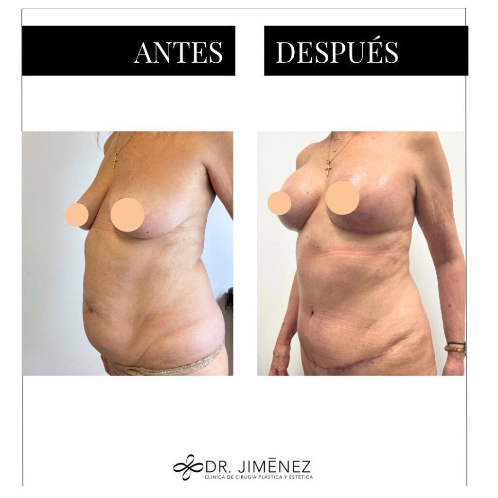 Instagram post from clinicadr.jimenez. This post is in position 1.