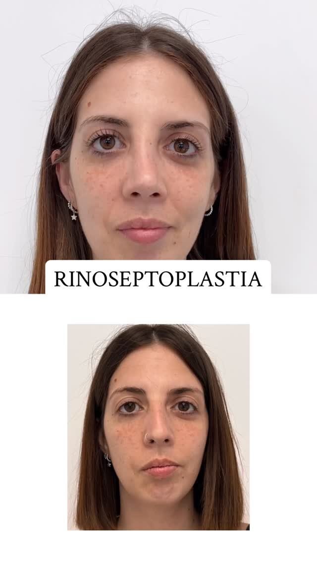 Instagram post from clinicadr.jimenez. This post is in position 4.