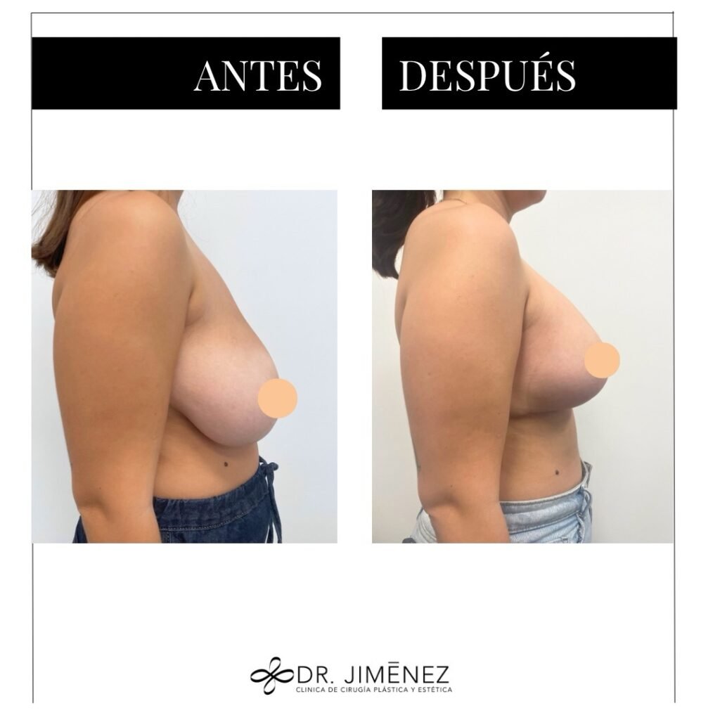 Instagram post from clinicadr.jimenez. This post is in position 2.