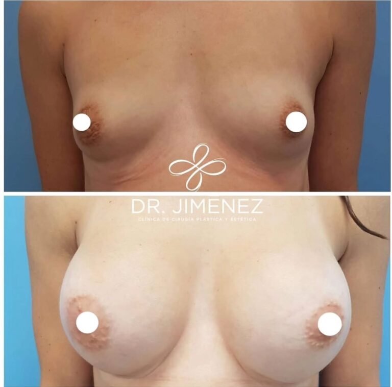 Instagram post from clinicadr.jimenez. This post is in position 5.