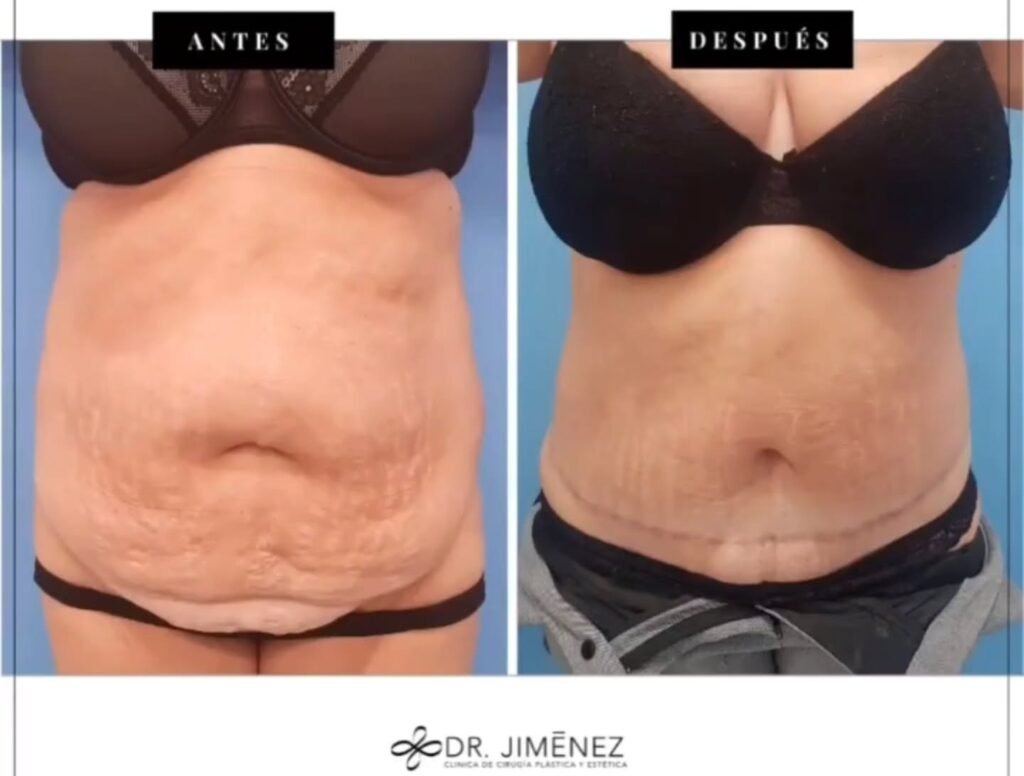 Instagram post from clinicadr.jimenez. This post is in position 3.