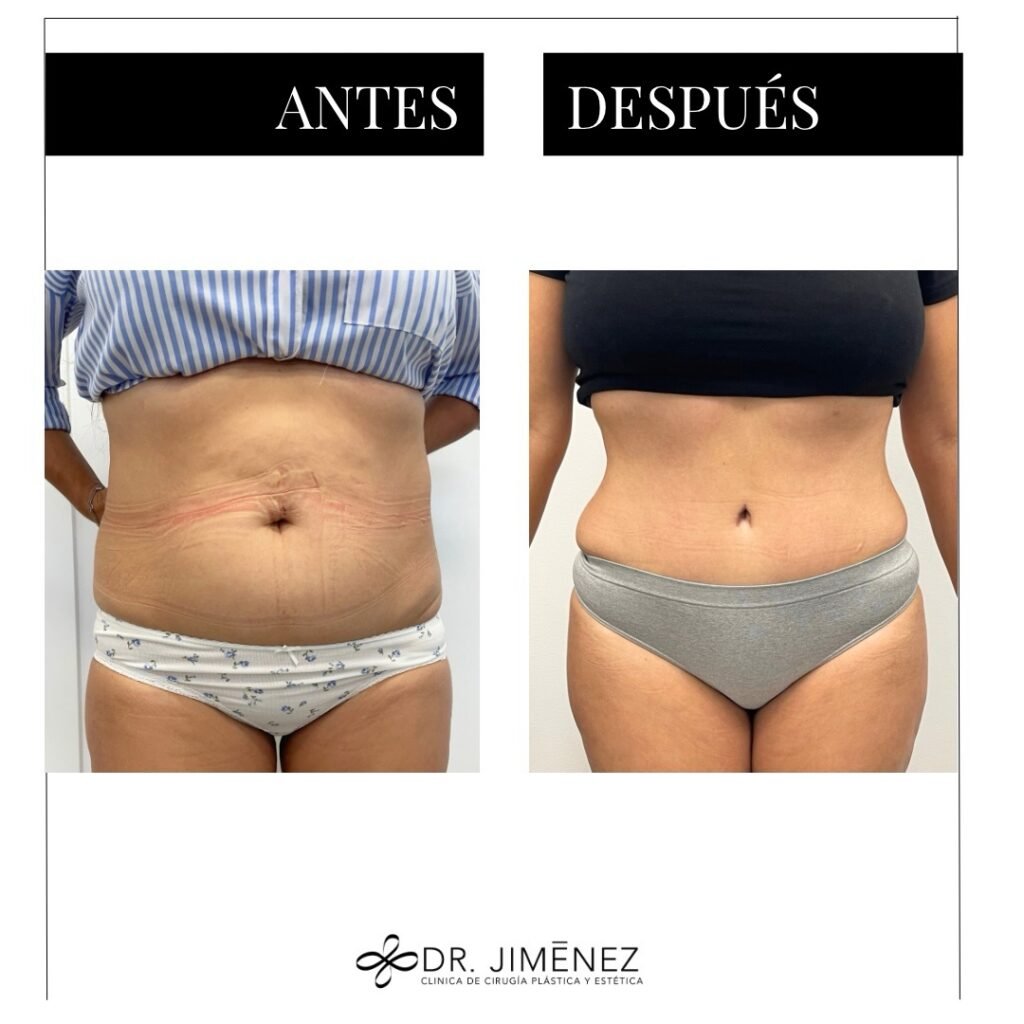 Instagram post from clinicadr.jimenez. This post is in position 0.